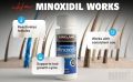 Kirkland Minoxidil 5% USA One Month Supply + Free Dropper. 