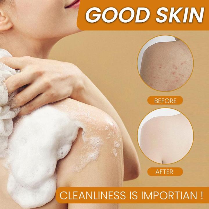 Turmeric%20Soap%20Lemon%20Soap%20Kojic%20Acid%20Soap%20Lemon%20Ginger%20Hand%20Made%20Body%20Shower%20and%20Facial%20Soap%20100g%20Deep%20Cleaning%20Antioxidant%20-%20Image%203