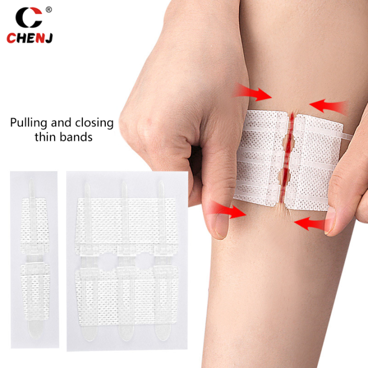 Closure Patch Zipper Wound Closure Patch Zipper Band-Aid Wound Fast Suture Outdoor ...