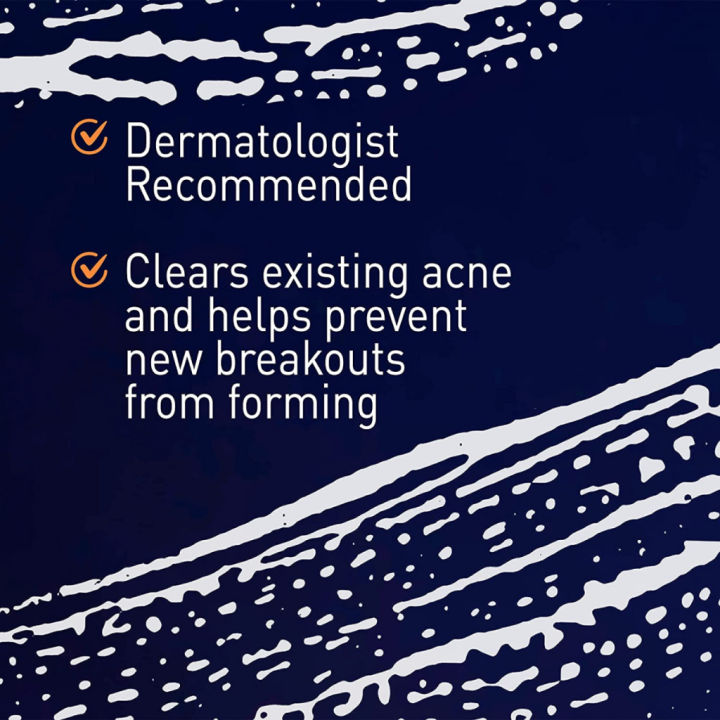 %5BSG%5D%20PanOxyl%20Acne%20Creamy%20Wash%204%25%20Benzoyl%20Peroxide%20Daily%20Control%20Facial%20Cleanser%20Skin%20Care,%20170g%20-%20Image%202