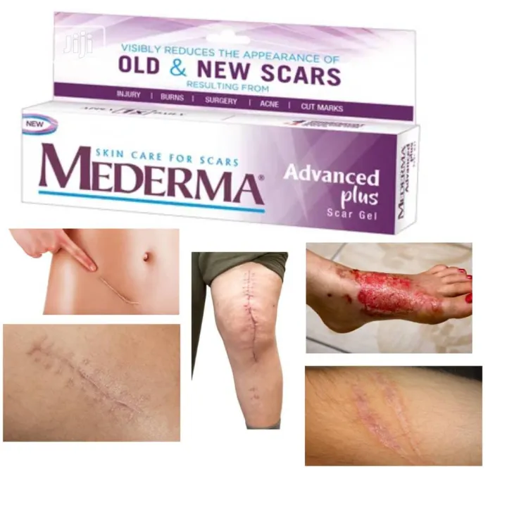 Mederma%C2%AE%20Advanced%20Plus%20Scar%20Gel%20Skin%20Care%20for%20new%20old%20Scars%20%7Ccut%20marks%20-%20Image%203