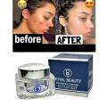 Royal Beauty Day & Night Fairness Cream (rbfc). 