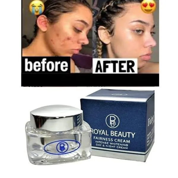 Royal%20Beauty%20Day%20&%20Night%20Fairness%20Cream%20(rbfc)%20-%20Image%203