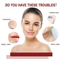 30ml Original Essence RETINOL B3/HYALU B5/NIACINAMIDE 10/CICAPLAST B5/VC10 Serum Facial Skin Care. 