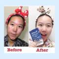 Frozen Collagen Skin Whitening with Glutathione capsules 60. 