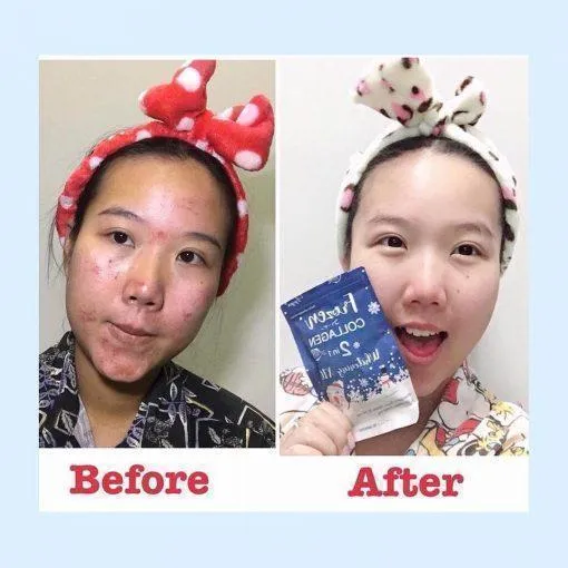 Frozen%20Collagen%20Skin%20Whitening%20with%20Glutathione%20capsules%2060%20-%20Image%204