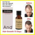 Andrea Hair Growth Essence Oil 20ml Ahgo Scalp Treatment Hair Growth & Stop Hair Loss. 