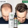 PURC Rosemary Oil Hair Growth Products for Man Women Ginger Anti Hair Loss Fast Regrowth Thicken Oils Scalp Treatment Hair Care. 