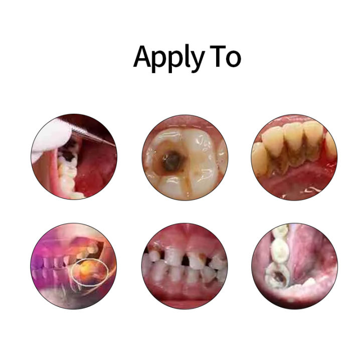 Tooth%20Pain%20Relief%20Treatment%20Spray%20Toothache%20Cure%20Teeth%20Decay%20Rsimple%20emover%20Killer%20Periodontitis%20Cleaner%20Angelica%20Dahurica%20Medicine%20-%20Image%203