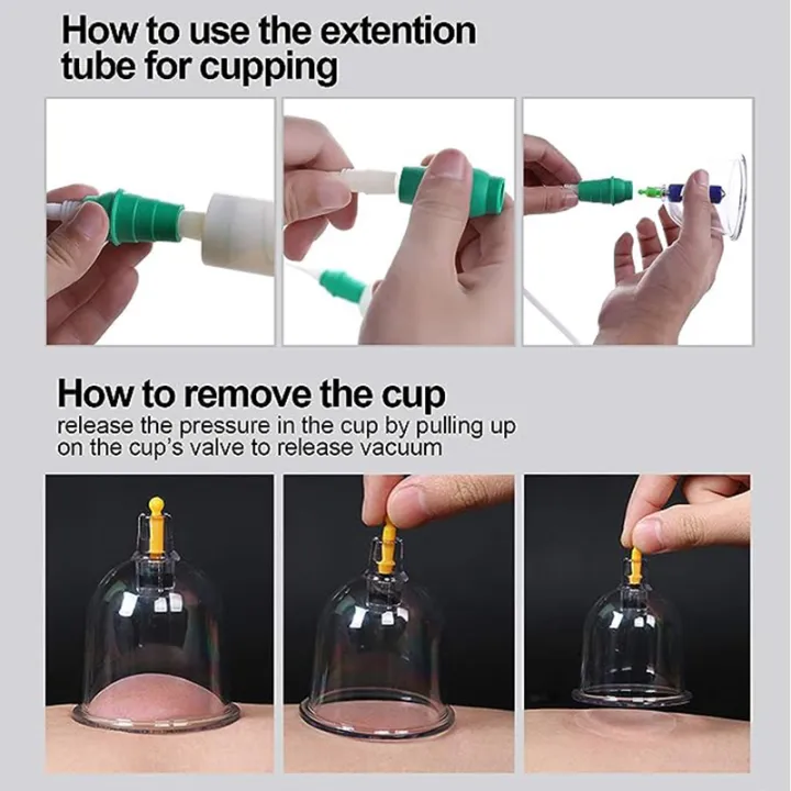 32%20Cupping%20Therapy%20Set%20Vacuum%20Massager%20Ventosa%20Professional%20Suction%20Cups%20Vacuum%20Massage%20Jars%20Physiotherapy%20Guasha%20Health%20Care%20-%20Image%202