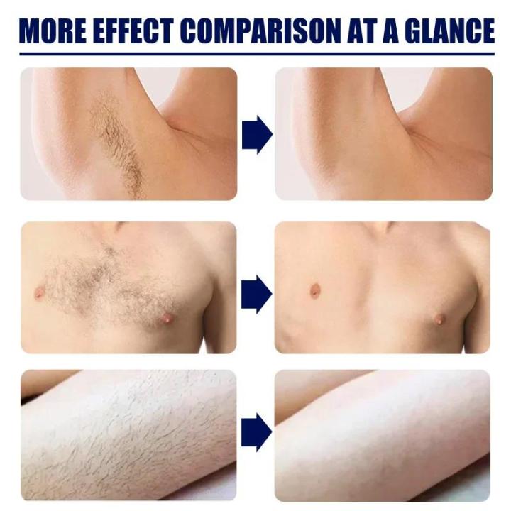 Permanent%20hair%20removal%20cream%20for%20men%20Body%20Skin%20care%20armpit%20Beard%20remover%20Effective%20Legs%20Arms%20chest%20hair%20Painless%20depilation%20wax%20-%20Image%202
