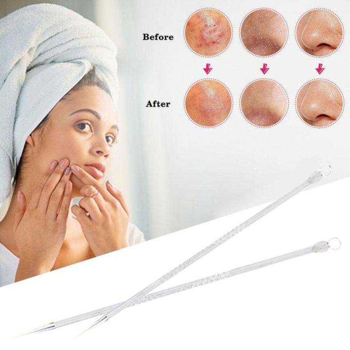 2PCS%20Acne%20Removal%20Needle%20Double%20Side%20Stainless%20Steel%20Skin%20Blackhead%20Remover%20Pimple%20Comedo%20Extractor%20Blackhead%20Pick%20Acne%20Stick%20-%20Image%205