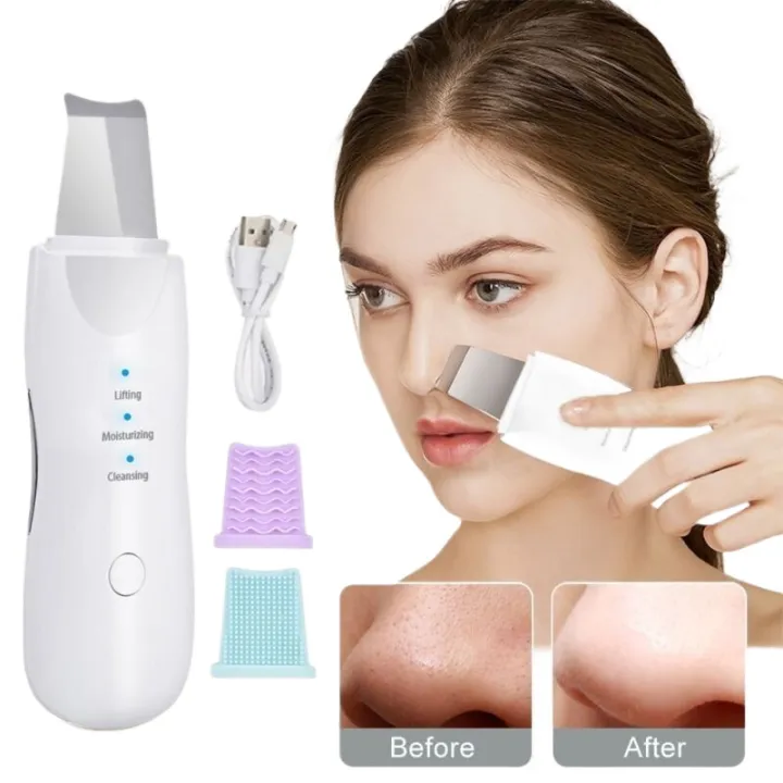 Ultrasonic%20Facial%20Cleansing,%20Skin%20Scrubber%20Facial%20Device%20SMT%20-%20Image%203