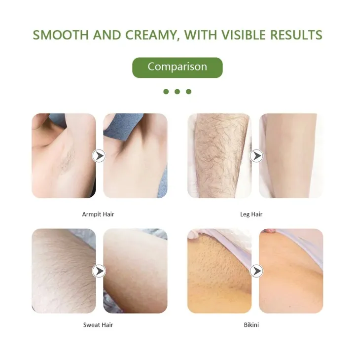 Women%20Electric%20Epilator%20Portable%20Armpit%20Leg%20Hair%20Removal%20Machine%20Underarms%20Bikini%20Hair%20Remover%20for%20Facial%20Wholebody%20Home%20Use%20-%20Image%205