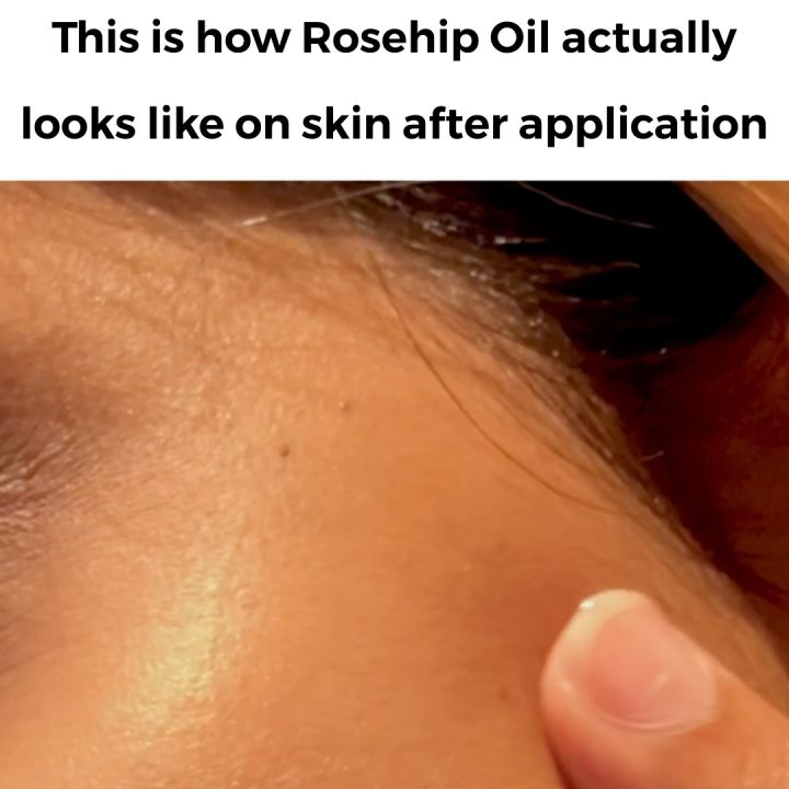 Cliara%20Rosehip%20Oil%2010Ml%20-%20Image%209