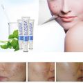 Bioaqua Pure Skin Face Care Acne Treatment Scar Removal Cream Stretch Marks Pimples Blackheads. 