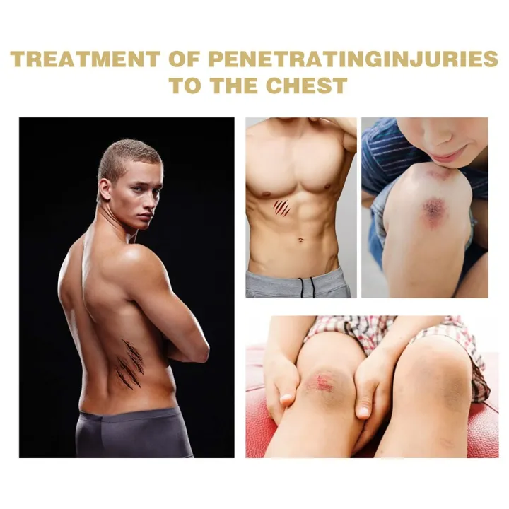 6pcs%20Emergency%20Trauma%20Sticker%20Chest%20Seal%20Medical%20Chest%20Seal%20Vented%20First%20Aid%20Patch%20Wound%20Dressing%20Outdoor%20Safety%20Survival%20Tool%20-%20Image%204