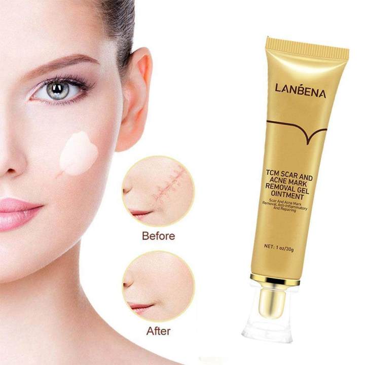 LANBENA%20TCM%20Scar%20&%20Acne%20Mark%20Removal%20Gel%20Ointment%20-%2030g%20-%20Image%204