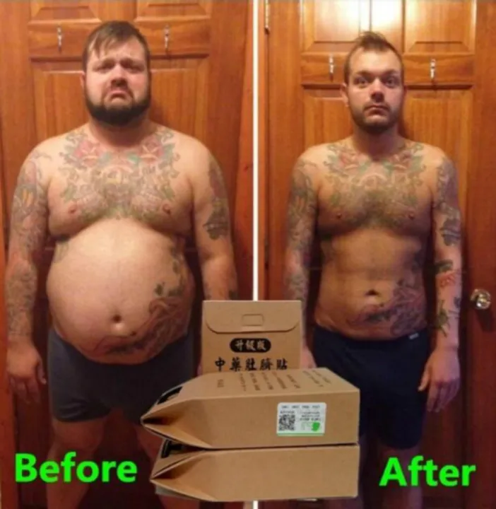 Fat%20Burning%20Patch%20Belly%20Patch%20Dampness-Evil%20Removal%20Improve%20Stomach%20Discomfort%20Chinese%20Slimming%20Patch%20Navel%20Sticker%20Health%20Slime%20-%20Image%204