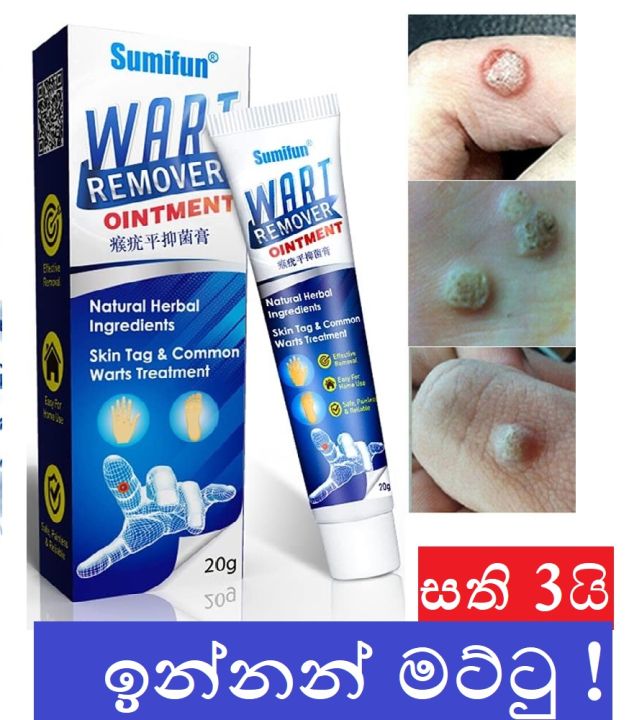 Sumifun Wart mole and Tag safe Remover without pain Ointment Herbal Extract Cream 20g with box
