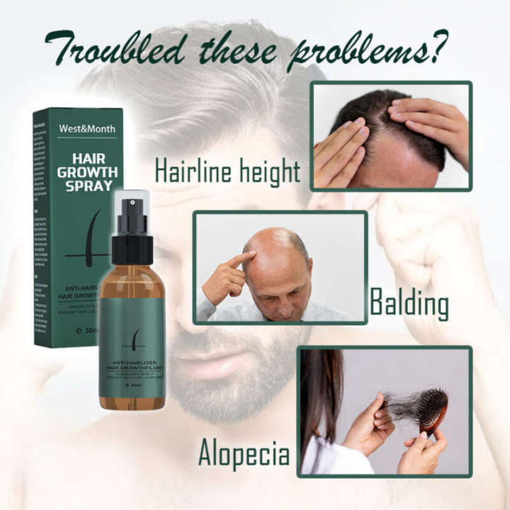 WEST&MONTH%20BEARD%20GROWTH%20ESSENTIAL%20OIL%20JAMBANG%20JANGGUT%20REGROWTH%20HAIR%20TONIC%20-%20Image%203