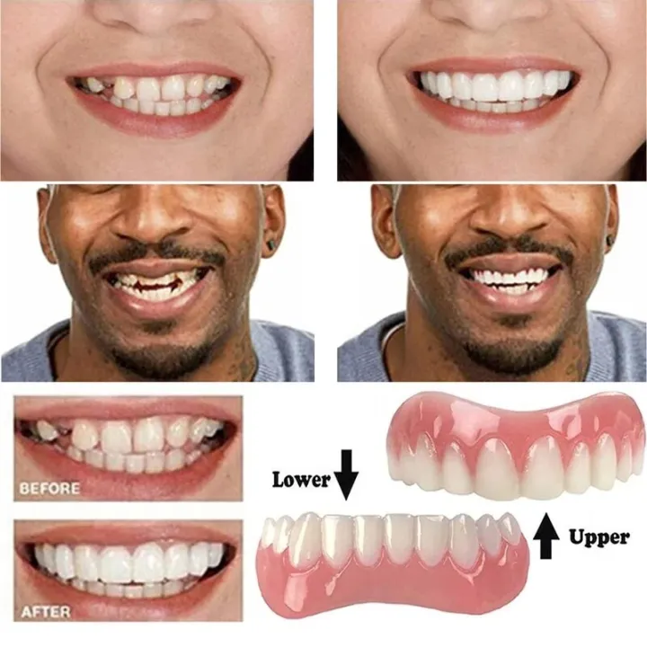 False%20Teeth%20Silicone%20Upper%20Lower%20Veneers%20Perfect%20Laugh%20Veneers%20Dentures%20Paste%20Teeth%20Braces%20for%20Tooth%20Oral%20Hygiene%20ToolsBasketball%20-%20Image%203