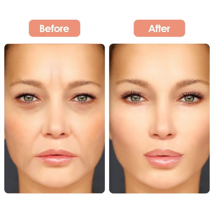 5PCS%20Reusable%20Anti%20Aging%20Wrinkle%20Removal%20Stickers%20Forehead%20Cheek%20Neck%20Eye%20Facial%20Firming%20Patch%20Pad%20Invisible%20Face%20Lifting%20Strips%20-%20Image%203