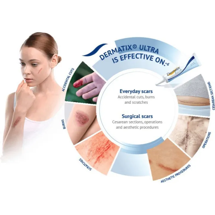 Good%20day%20Dermatix%20Ultra%20Scar%20Gel%20Scar%20Remover%20Cream%20Scar%20Reduction%20Cream%20Remove%20Fade%20Scars%20Advanced%20Scar%20Gel%20Skin%20Repair%20Scars%20Burns%20Cuts%20Pregnancy%20Stretch%20Marks%20-%20Image%207