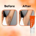 INTIMIFY Underarm Whitening Cream for Women, Armpit Whitening Cream Natural with Kojic Acid & Vitamin B3 20g(FROM INDIA)NUSS. 