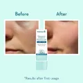 WishCare 5% Niacinamide Oil Balance Fluid Sunscreen SPF 50 PA++++ with 8 Hrs+ SPF Protection- Lightweight Matte Sunscreen SPF 50 for Oily Skin & No White Cast 50g. 