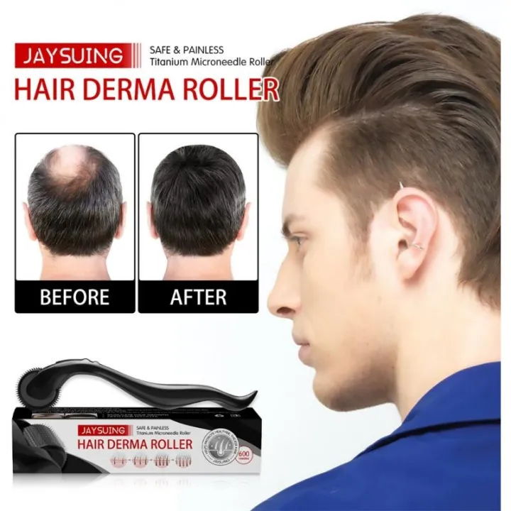 New%20Dermaroller%20For%20Men%20Micro%20Hair%20Derma%20Roller%20Regrowth%20Beard%20Growth%20Anti%20Loss%20Roll%20Tool%20%E3%80%90hot%E3%80%91%E2%99%82%E2%9C%B4%E2%9C%93%20-%20Image%202