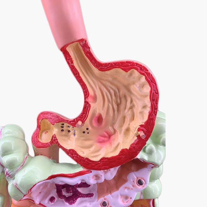 ARELENE Human Digestive System Model Stomach Anatomy Large Intestine ...