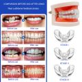 Orthodontic Braces Dental Braces Smile Teeth Alignment Trainer Instanted Silicone Teeth Retainer Mouth Guard Braces Tooth Tray. 
