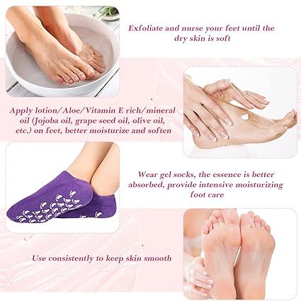 Socks%20Heel%20Gel%20Sock%20-%20Callus%20Rough%20Foot%20Care%20Treatment%20Soft%20Silicone%20Gel%20Lined%20Infused%20Lotion%20Spa%20Socks%7C1%20Pairs%20Cotton%20Gel%20Sleeves%20for%20Repairing%20Softening%20Dry%20Cracked%20Feet%20Skins%20-%20Image%207