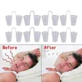 8 Pcs/Set Snoring Solution Anti Snoring Devices Professional Nose ZH. 
