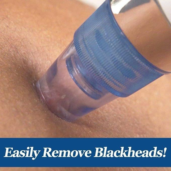 4%20in%201%20Multi-function%20Blackhead%20Remover%20Vacuum%20Pimple%20Tool%20For%20Men%20And%20Women%20Blackheads%20Remover%20Tool%20Kit,%20Acne%20Remover,%20Pore%20Cleaner,%20Facial%20Beauty%20Care%20-%20Image%205