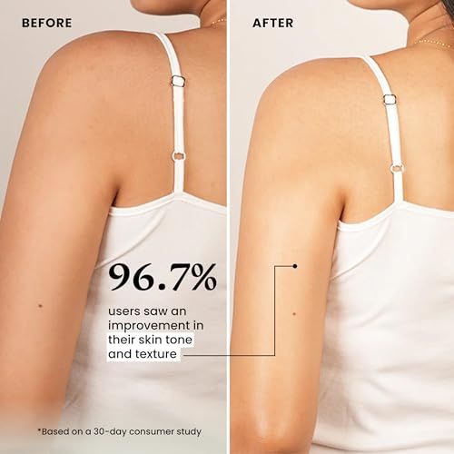 Foxtale%20SPF%2030%20Detan%20Brightening%20Body%20Lotion%20with%20Niacinamide%20&%20Vitamin%20C%20for%20Glowing%20Skin%20%7C%20Lightweight%20&%20Non-Sticky%20%7C%20Prevents%20Tan%20%7C%20Sun%20Protection%20%7C%20Long%20Lasting%20Floral%20Fragrance%20%7C%20Body%20Lotion%20for%20Men%20&%20Women%20%7C%20All%20Skin%20Type%20%7C%20200%20ml(FROM%20INDIA)%20-%20Image%204