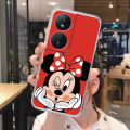 For Huawei Honor X7b 4G 90 Smart 5G Phone Case Couple Mickey Minnie Mouse Stitch Silicone Clear Transparent Bumper Back Cover. 