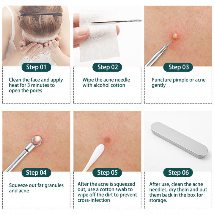 8PCS%20Blackhead%20Remover%20Kit,%20Comedone%20Pimple%20Extractor%20Tool%20Acne%20Removal%20Kit%20Acne%20Needle%20Blemish%20Remover%20Set%20for%20Blackhead,%20Whitehead%20Popping%20with%20Case%20-%20Image%208