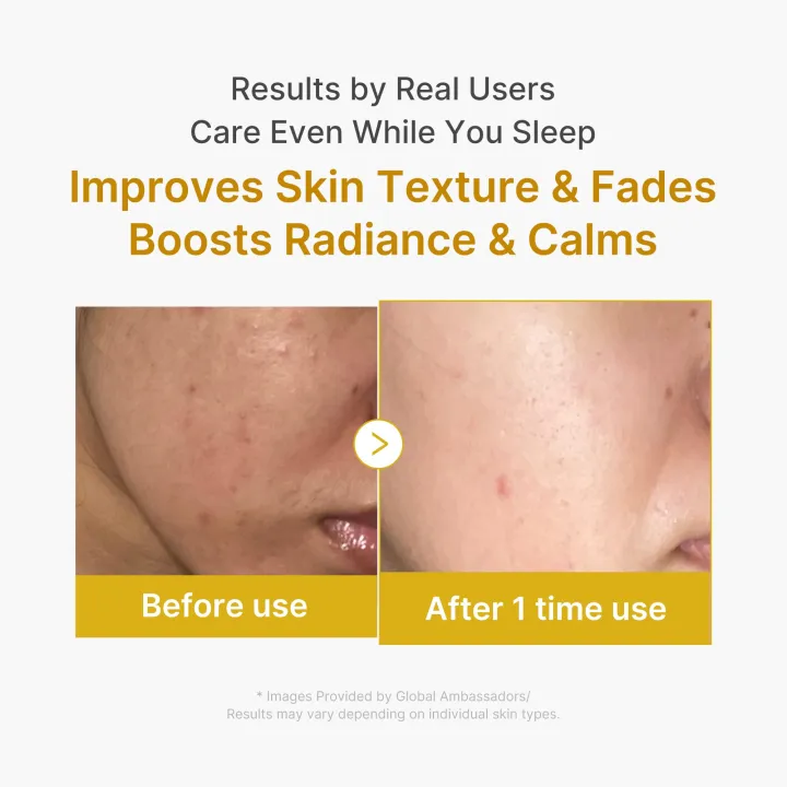 Medicube%20Kojic%20Acid%20Turmeric%20Overnight%20Wrapping%20Mask%20Brightens%20Skin%2075ml%20-%20Image%204