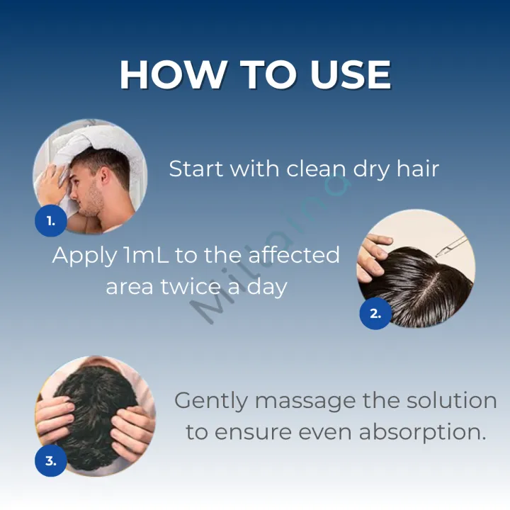 Kirkland%20Signature%20Minoxidil%205%25%20Topical%20Solution%20for%20Hair%20&%20Beard%20Growth%20%E2%80%93%202%20Months%20Supply%20+%20Original%20Dropper%20Applicator%20%E2%80%93%20USA%20Imported%20-%20Image%205