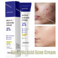 Salicylic Acid Acne Treatment Acne Remover Face Remove Deep Acne Scars Gel Oil Control Shrink Pores Blackheads Care. 