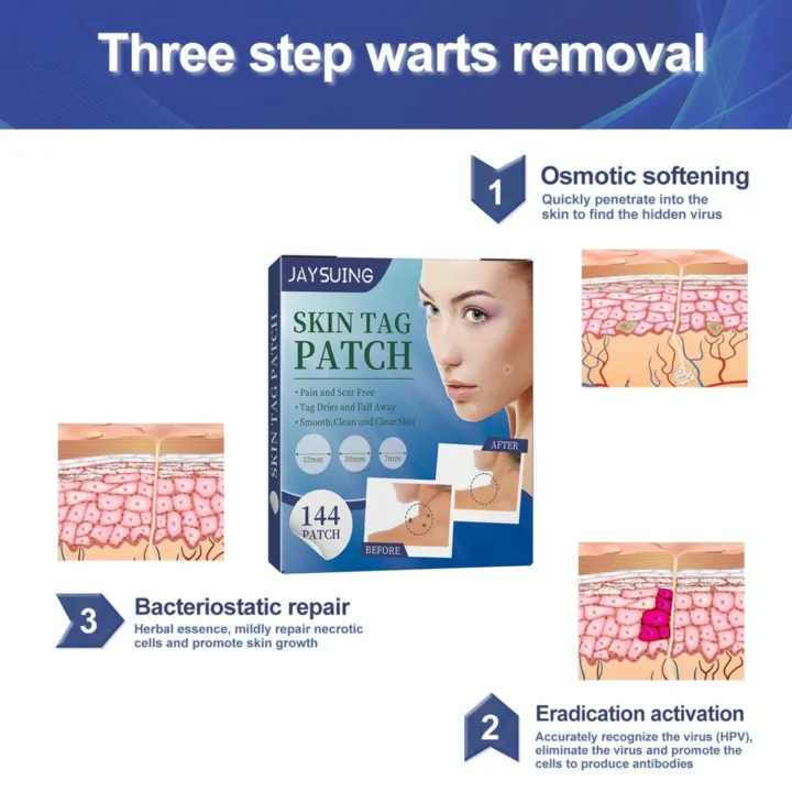 Skin%20Tags%20Remover%20Patch%20-%20144pcs%20-%20Image%204