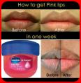 Vaseline Lip Therapy for soft, smooth, Rosy lips 7g. 