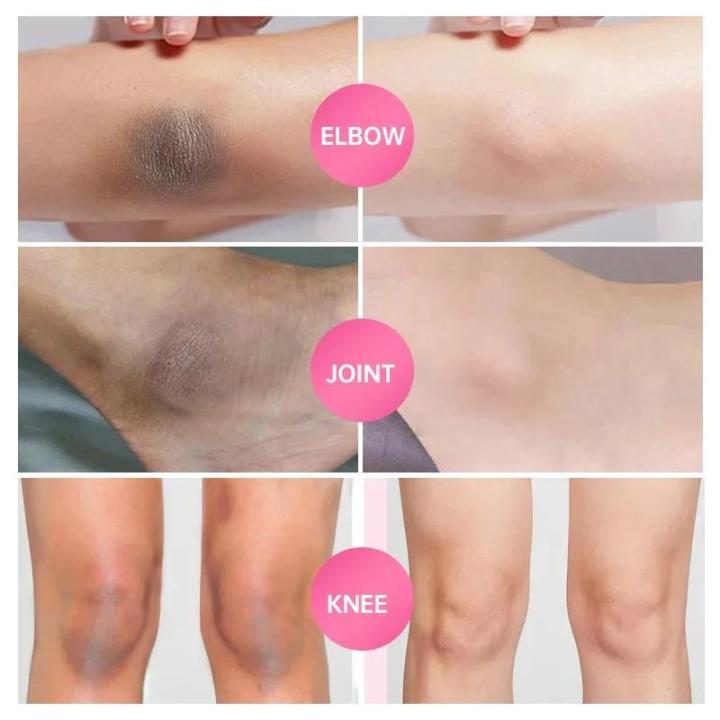 Body%20Brightening%20Cream%20Lightening%20Elbow%20and%20Knee%20Joint%20Black%20Exfoliating%20Cream%20Improving%20Dark%20Inner%20Thigh%20Skin%20Under%20Armpit%20-%20Image%206
