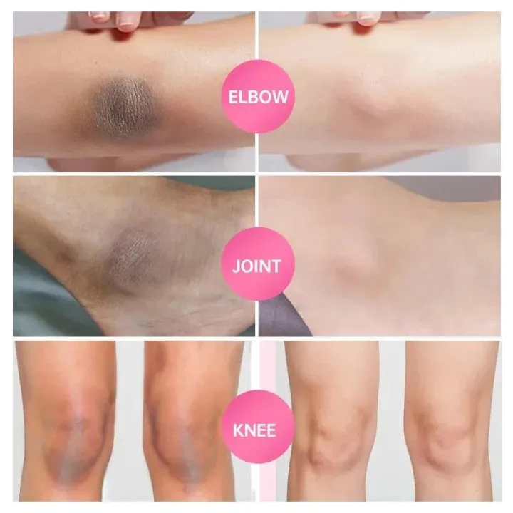 Body%20Brightening%20Cream%20Lightening%20Elbow%20and%20Knee%20Joint%20Black%20Exfoliating%20Cream%20Improving%20Dark%20Inner%20Thigh%20Skin%20Under%20Armpit%20-%20Image%206