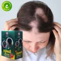 Ayurvedic Udugowwa Balm & Oil Pack – Effective Herbal Remedy for Hair Loss. 
