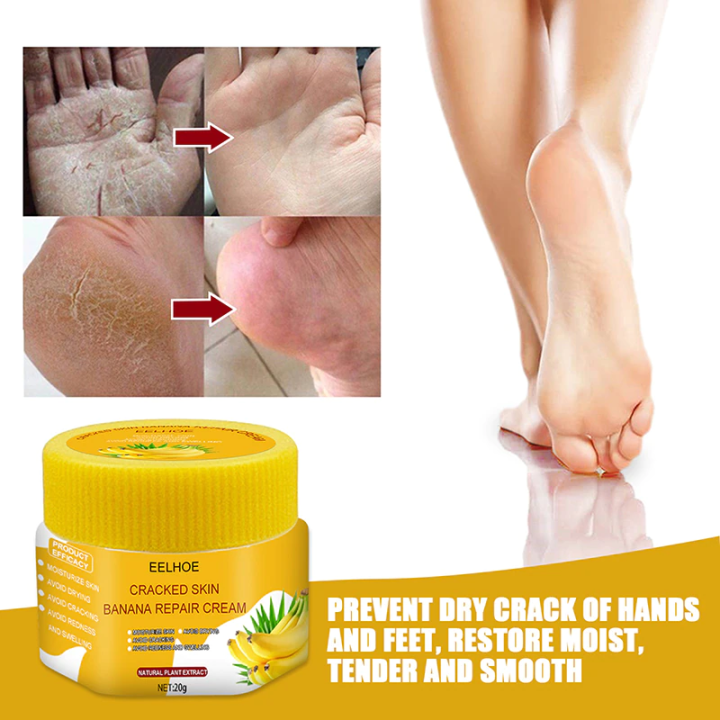 Foot crack repair and dryness healing cream 20g big pack Natural ingredients