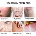 Roushun aloevera for soothing & Moisturizing aloe vera 99% gel 300mlRoushun aloe vera gel Natural Aloe Soothing Gel Smoothing Gel Skin Care Face Sun Repair Whitening Moisturizing Cream Women Sunscreen roushun කෝමාරිකා ජෙල්. 