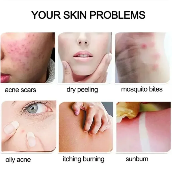 Roushun%20aloevera%20for%20soothing%20&%20Moisturizing%20aloe%20vera%2099%25%20gel%20300mlRoushun%20aloe%20vera%20gel%20Natural%20Aloe%20Soothing%20Gel%20Smoothing%20Gel%20Skin%20Care%20Face%20Sun%20Repair%20Whitening%20Moisturizing%20Cream%20Women%20Sunscreen%20roushun%20%E0%B6%9A%E0%B7%9D%E0%B6%B8%E0%B7%8F%E0%B6%BB%E0%B7%92%E0%B6%9A%E0%B7%8F%20%E0%B6%A2%E0%B7%99%E0%B6%BD%E0%B7%8A%20-%20Image%203